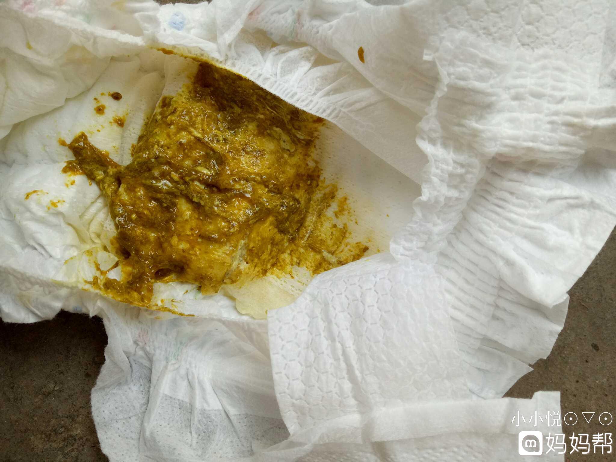 老回事宝宝拉稀是积食吗_老回事宝宝拉稀是什么原因_宝宝老是拉稀怎么回事