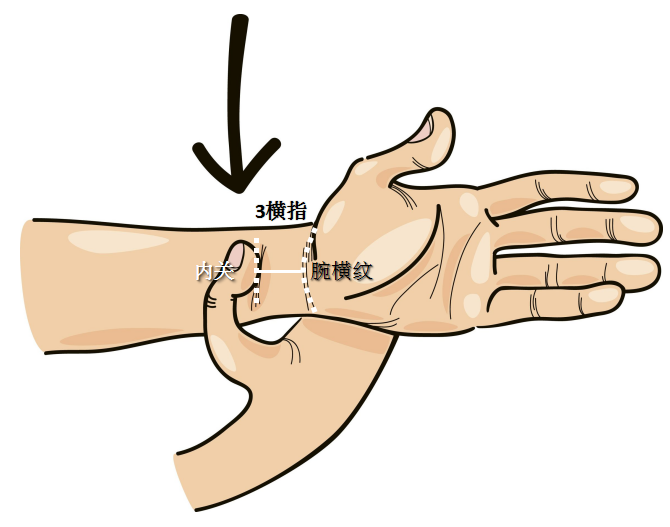 呕吐治疗原则_中枢神经性呕吐治疗_治疗呕吐