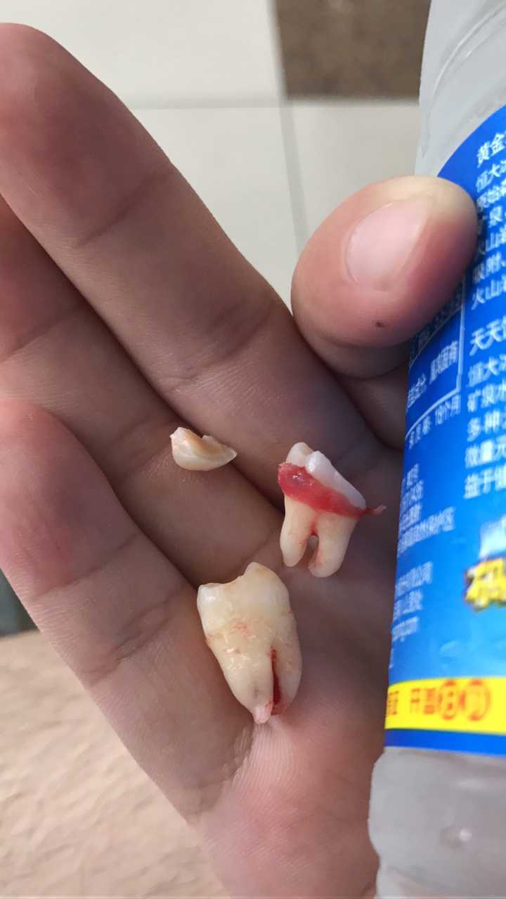 智齿下载720p_智齿在线下载_智齿下载